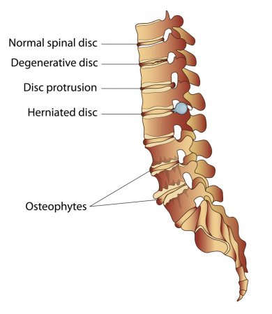 Parts of spinal cord - Diagrammic Explanation